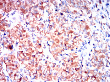 TTR Antibody