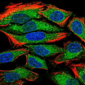 ACLY Antibody