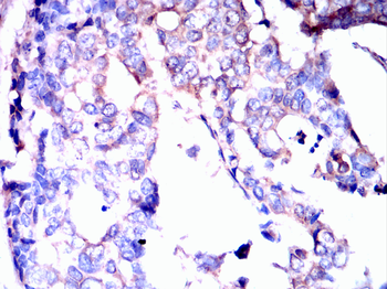 ACLY Antibody