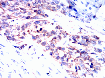 ACLY Antibody