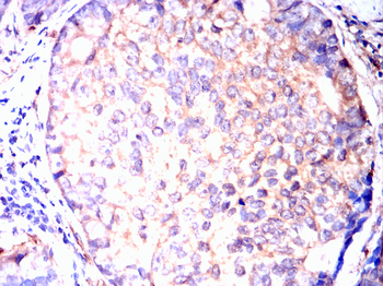 ACLY Antibody