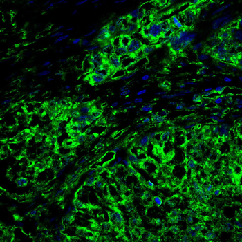 RPS3 Antibody