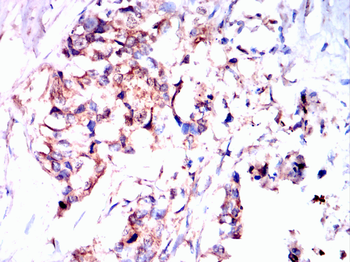 HAPLN1 Antibody