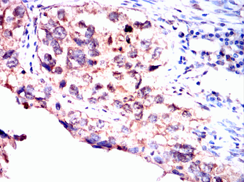 HAPLN1 Antibody