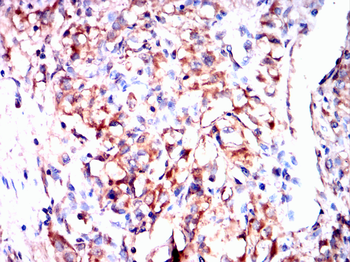 HAPLN1 Antibody