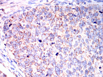 YBX1 Antibody