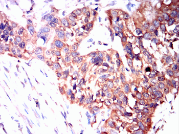 YBX1 Antibody