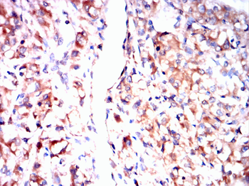 YBX1 Antibody