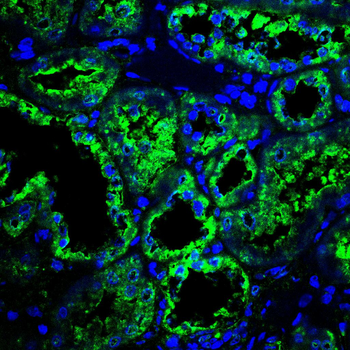 HSPH1 Antibody
