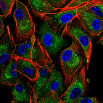FTL Antibody