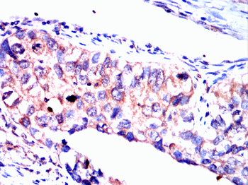 FTL Antibody