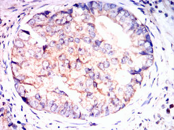 FTL Antibody