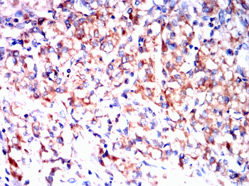 FTL Antibody