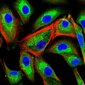 KL Antibody