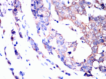 KL Antibody