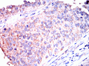 KL Antibody