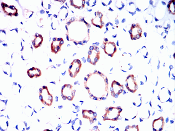 KL Antibody