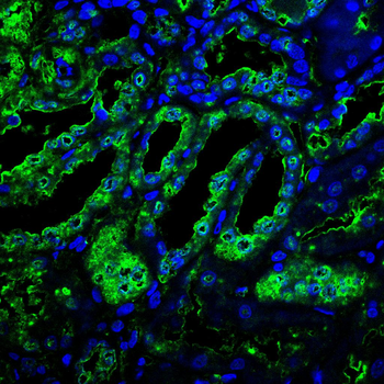 KL Antibody