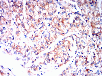 KL Antibody