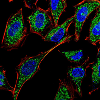 ULK1 Antibody