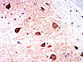 ULK1 Antibody