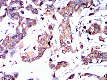 ULK1 Antibody