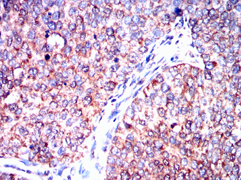ULK1 Antibody
