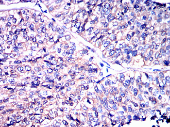 ULK1 Antibody