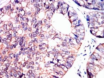 ULK1 Antibody