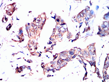 AXIN2 Antibody