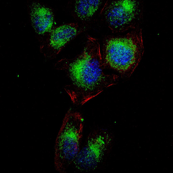 PRKCE Antibody