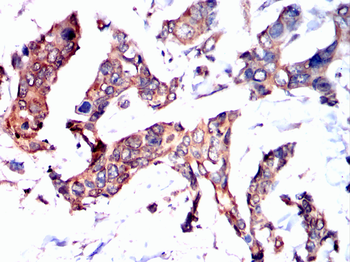 PRKCE Antibody