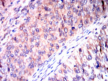 PRKCE Antibody