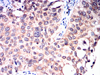 PRKCE Antibody