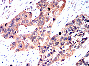 PRKCE Antibody