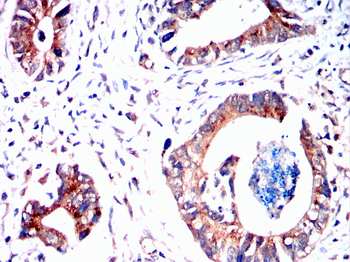 PRKCE Antibody