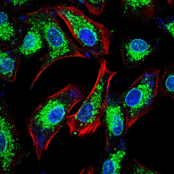 PFKFB3 Antibody