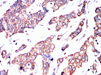 PFKFB3 Antibody
