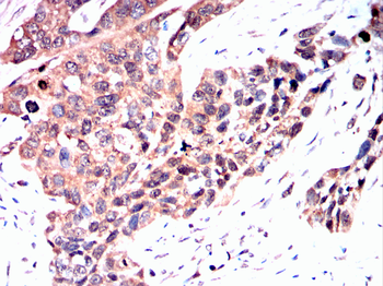PFKFB3 Antibody