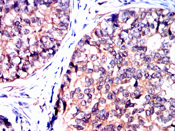 PFKFB3 Antibody