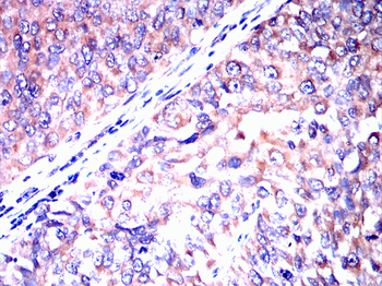 PDX1 Antibody