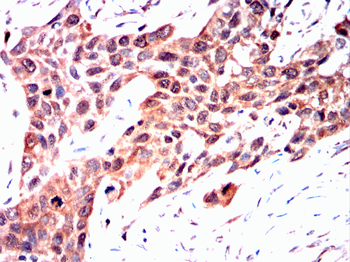 PDX1 Antibody