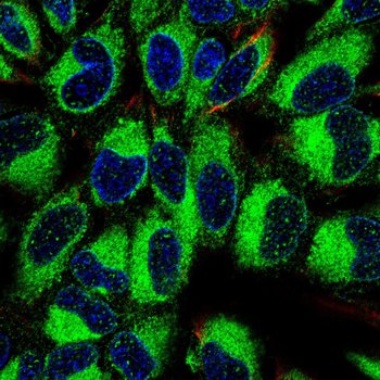 PARK7 Antibody