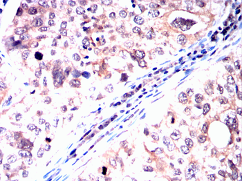 PARK7 Antibody