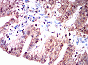 FKBP5 Antibody