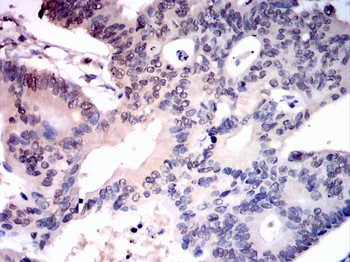 UBA1 Antibody