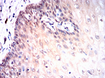 UBA1 Antibody