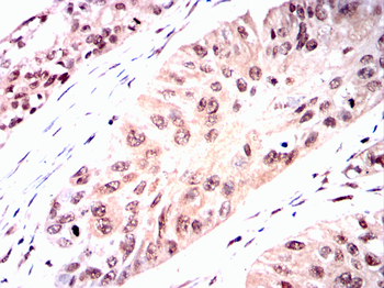UBA1 Antibody