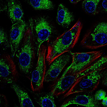 ATF5 Antibody