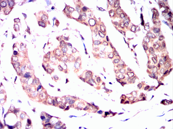 ATF5 Antibody